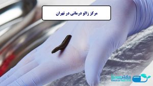 زالو درمانی در تهران
