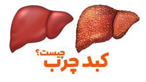 Fatty Liver (1)