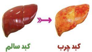Fatty Liver (8)