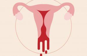 Menstrual bleeding (2)